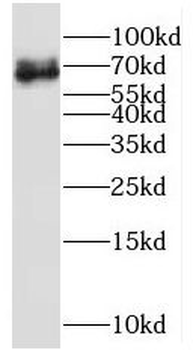 MPP7 Rabbit Polyclonal Antibody