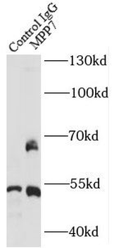 MPP7 Rabbit Polyclonal Antibody