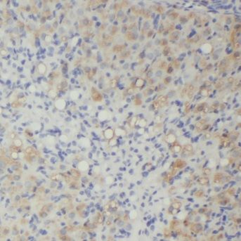 MPP7 Rabbit Polyclonal Antibody