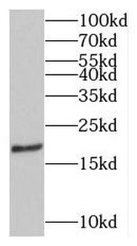 MPV17 Rabbit Polyclonal Antibody