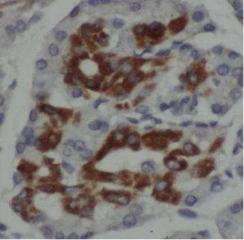 MPV17 Rabbit Polyclonal Antibody