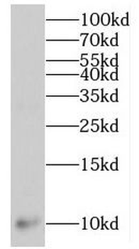 MPV17L Rabbit Polyclonal Antibody