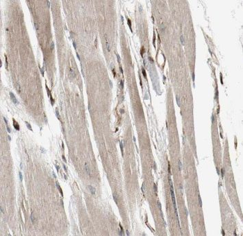 MRAS Rabbit Polyclonal Antibody