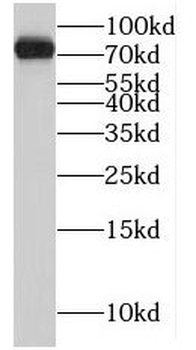 MRE11 Rabbit Polyclonal Antibody