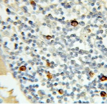 MRE11 Rabbit Polyclonal Antibody