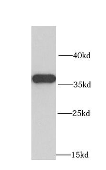 MRPL1 Rabbit Polyclonal Antibody