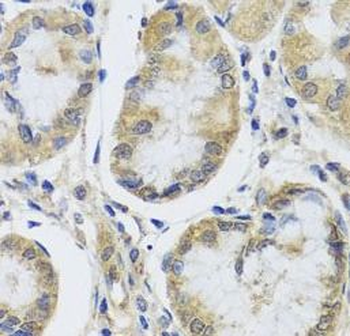 MRPL1 Rabbit Polyclonal Antibody