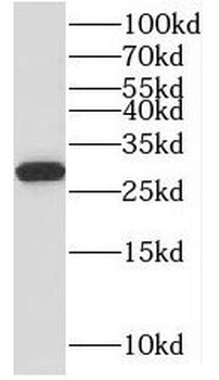 MRPL10 Rabbit Polyclonal Antibody