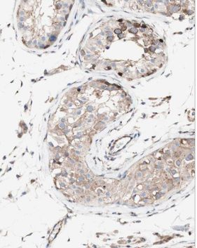 MRPL10 Rabbit Polyclonal Antibody