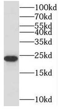 MRPL13 Rabbit Polyclonal Antibody