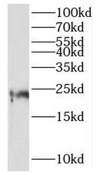 MRPL21 Rabbit Polyclonal Antibody