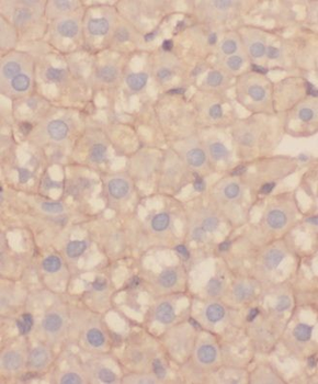 MRPL21 Rabbit Polyclonal Antibody