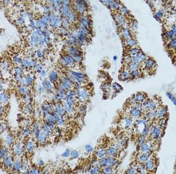 MRPL28 Rabbit Polyclonal Antibody