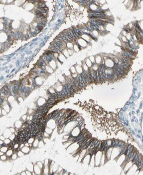 MRPL45 Rabbit Polyclonal Antibody