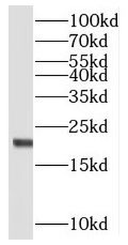 MRPL48 Rabbit Polyclonal Antibody