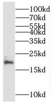 MRPL49 Rabbit Polyclonal Antibody
