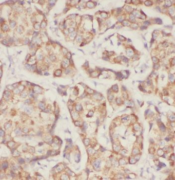 MRPL49 Rabbit Polyclonal Antibody