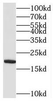 MRPL52 Rabbit Polyclonal Antibody