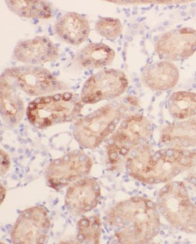 MRPL52 Rabbit Polyclonal Antibody