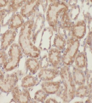 MRPS11 Rabbit Polyclonal Antibody