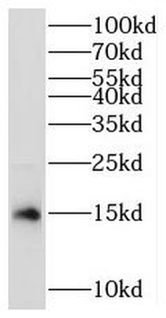 MRPS17 Rabbit Polyclonal Antibody