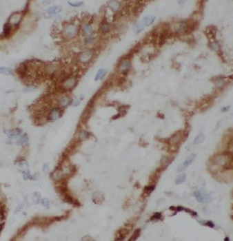 MRPS17 Rabbit Polyclonal Antibody