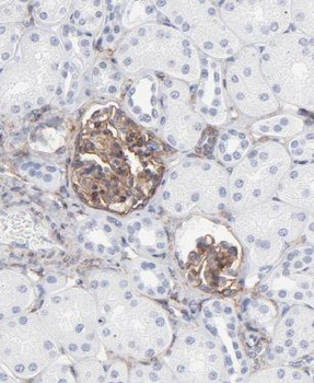 MRPS21 Rabbit Polyclonal Antibody