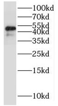 MRPS27 Rabbit Polyclonal Antibody