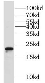 MRPS28 Rabbit Polyclonal Antibody