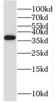 MRPS35 Rabbit Polyclonal Antibody
