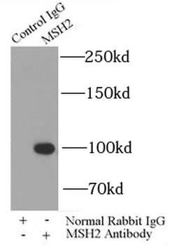 MSH2 Rabbit Polyclonal Antibody