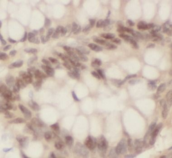 MSH2 Rabbit Polyclonal Antibody