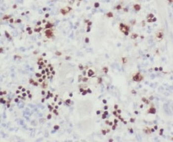 MSH6 Antibody