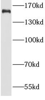 MSH6 Mouse Monoclonal Antibody