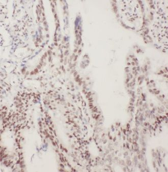 MSH6 Mouse Monoclonal Antibody