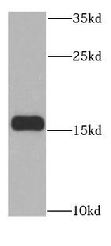 MSRB2 Antibody