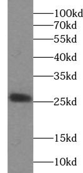 MSRB3 Rabbit Polyclonal Antibody
