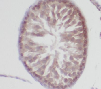 MSRB3 Rabbit Polyclonal Antibody