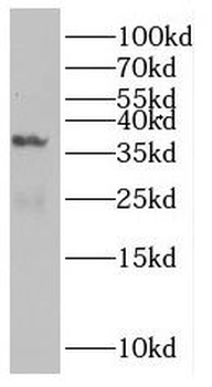 MTFR1 Rabbit Polyclonal Antibody