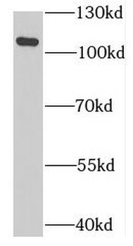 MTHFD1L Rabbit Polyclonal Antibody