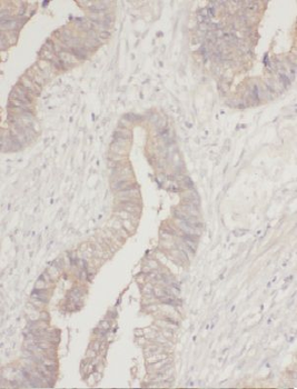 MTHFD1L Rabbit Polyclonal Antibody