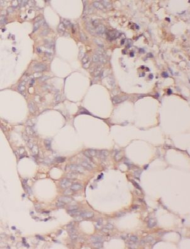 MTHFD2 Rabbit Polyclonal Antibody