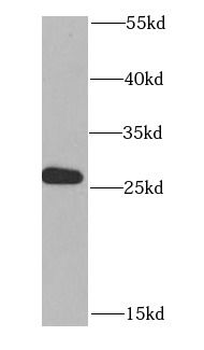 MTIF3 Rabbit Polyclonal Antibody