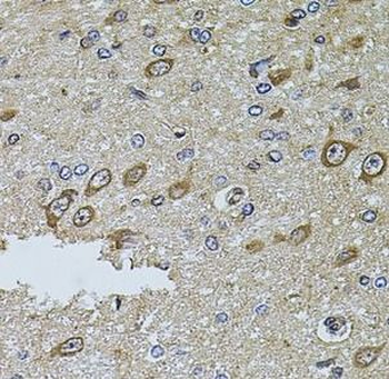 MTIF3 Rabbit Polyclonal Antibody