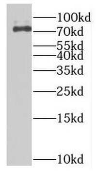 MTMR12 Rabbit Polyclonal Antibody