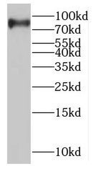 MTMR7 Rabbit Polyclonal Antibody