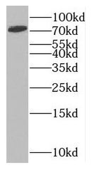 MTO1 Rabbit Polyclonal Antibody