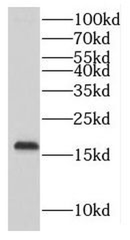 MTFP1 Rabbit Polyclonal Antibody