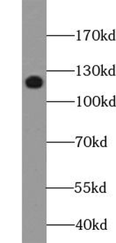 MUC1 Antibody