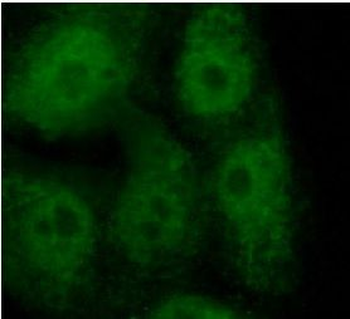 MX1 Rabbit Polyclonal Antibody